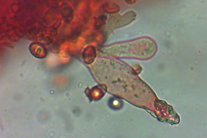 Melanoleuca cognata Zystiden mit Kristallen