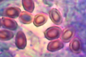 Leucoagaricus cinerascens Grauhuetiger Egerlingsschirmpilz Metachromatisch
