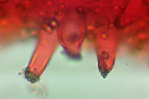 Inocybe fibrosa Weisser Risspilz Zystide mit Kongorot