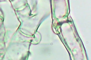 Cortinarius spec Schnallen