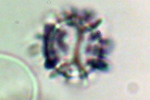 Lactarius pterosporus  Fluegelsporiger Milchling Sporen